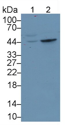 TDO2 Antibody (C2)