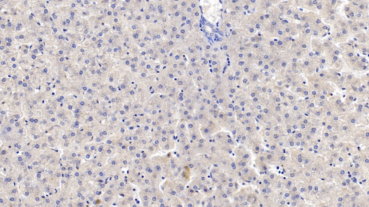 TDO2 Antibody (C2)