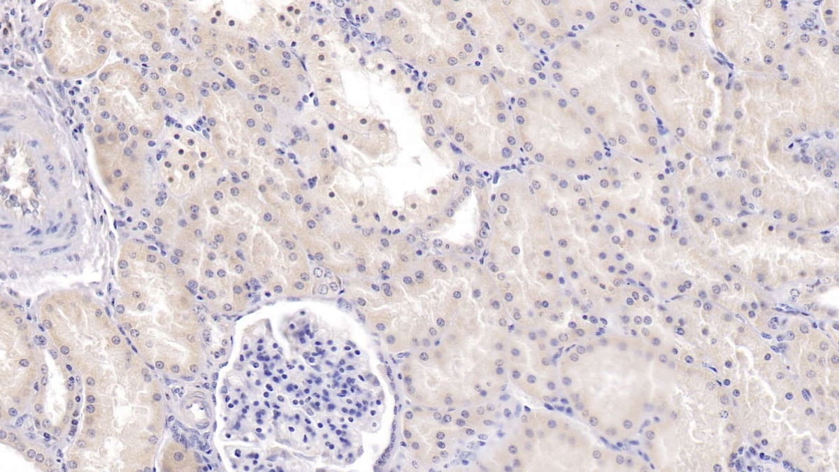 TDO2 Antibody (C10)