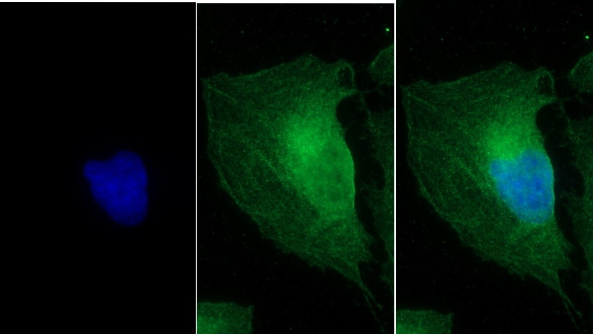 MYH8 Antibody (C1)