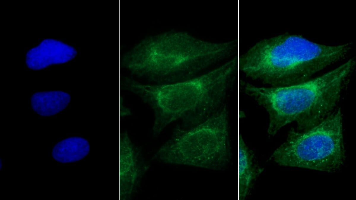 MYH8 Antibody (D2)