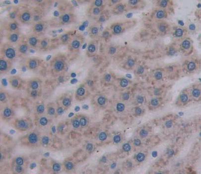 MTIF2 Antibody