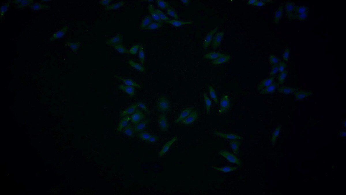 Serpin A10/ZPI Antibody (C6)