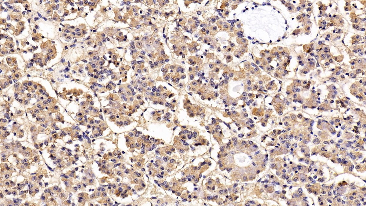 LH beta Antibody (H5)