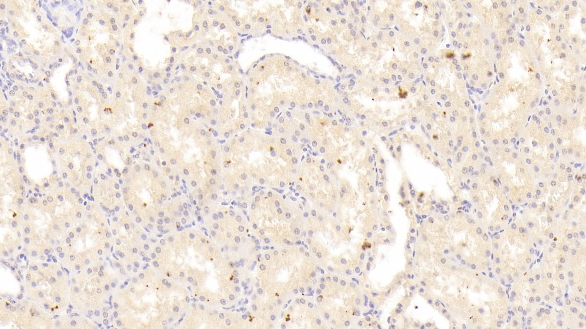 RIPK1/RIP1 Antibody (C4)