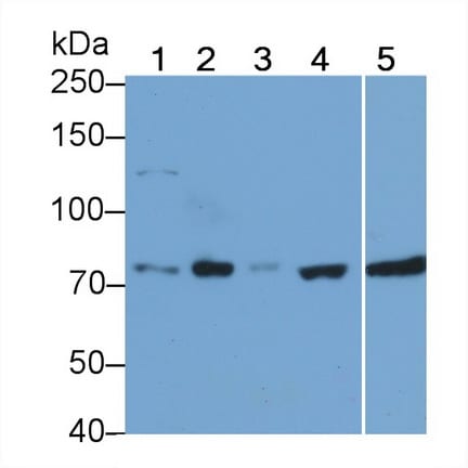 RIPK1/RIP1 Antibody (C4)