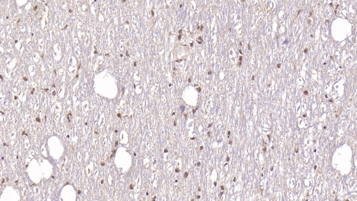 DCLK1 Antibody (C9)