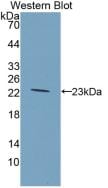 GCKR Antibody (4#)