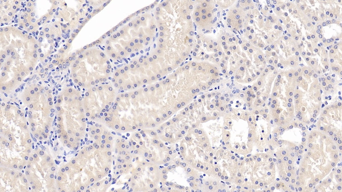SLC12A3 Antibody (C5)