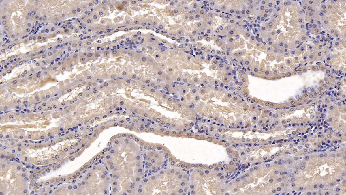 SLC12A3 Antibody (C9)