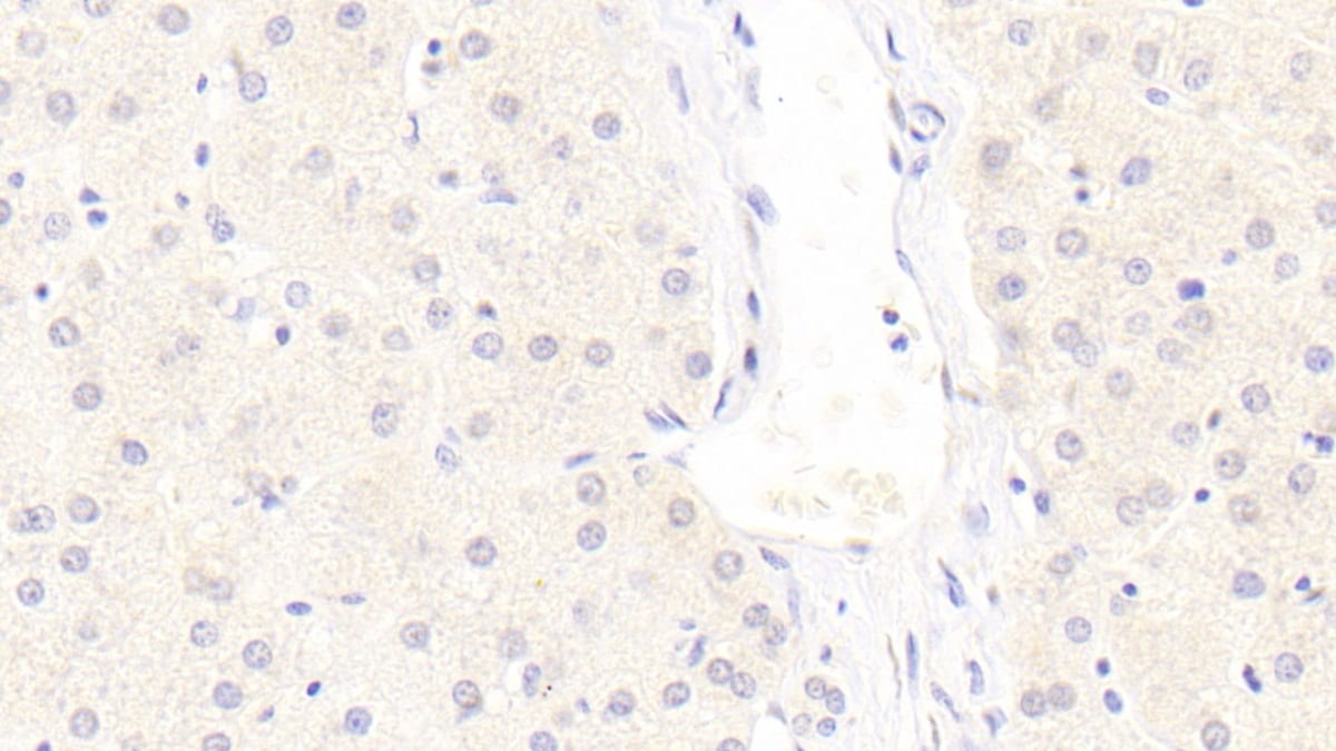 LRP-6 Antibody (C7)
