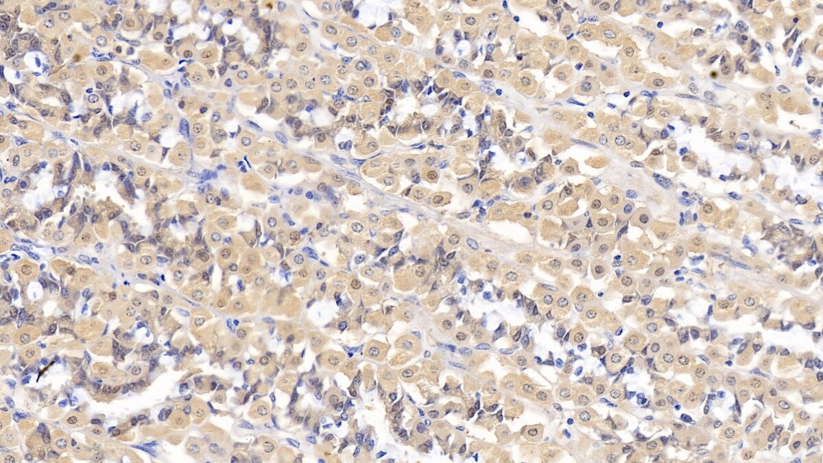 IFN-alpha F/IFNA21 Antibody (C7)
