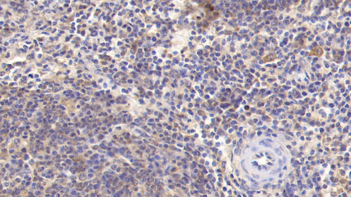 MAPRE1 Antibody (C5)