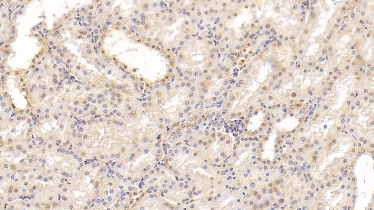 MAPRE1 Antibody (C5)