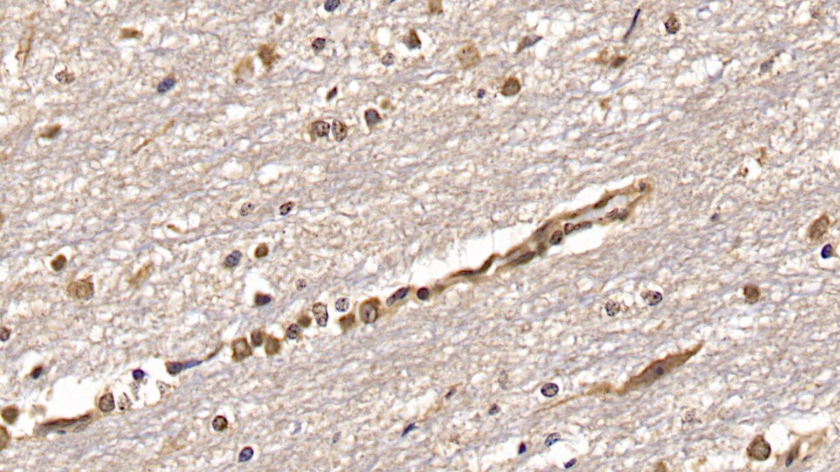 OAS2 Antibody (C5)