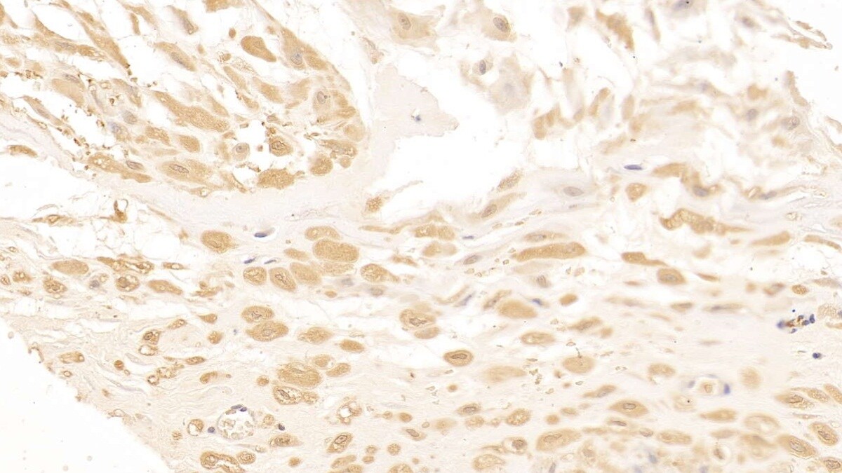 Casein Kinase 1 delta Antibody (C1)