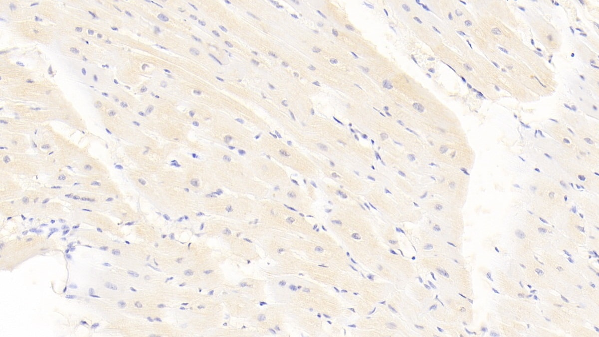 Calponin 2 Antibody (C15)