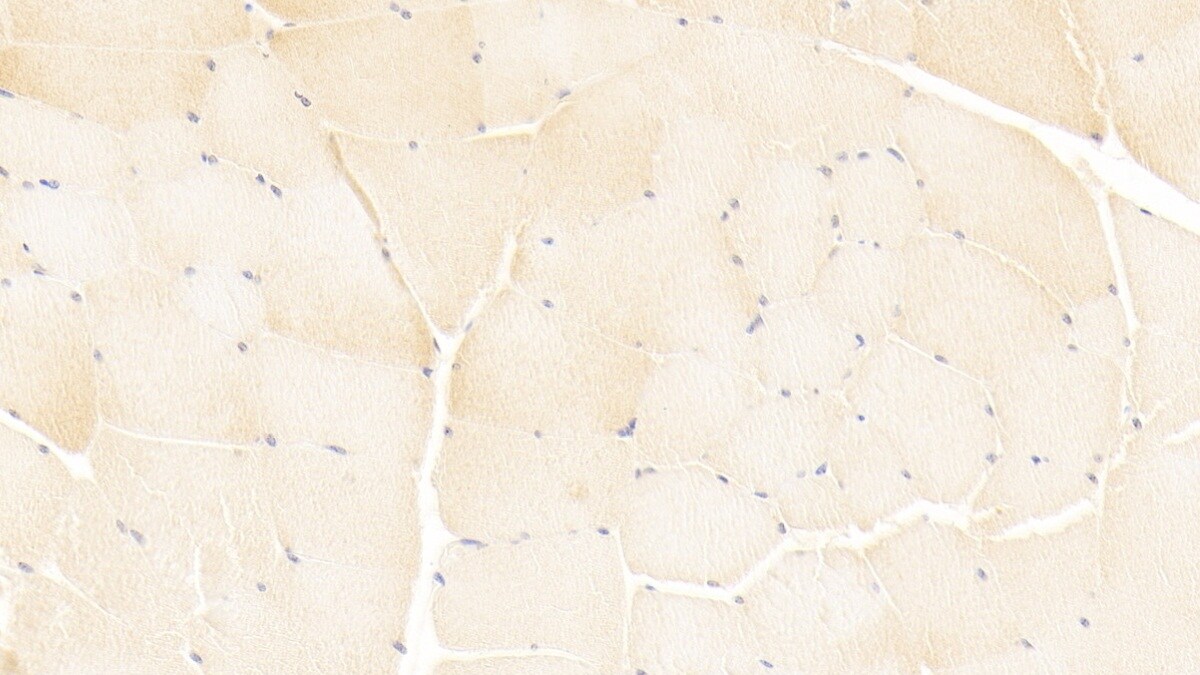 ISLR Antibody (C9)