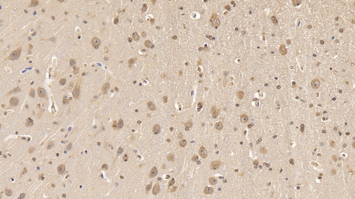 Apolipoprotein L2 Antibody (C3)
