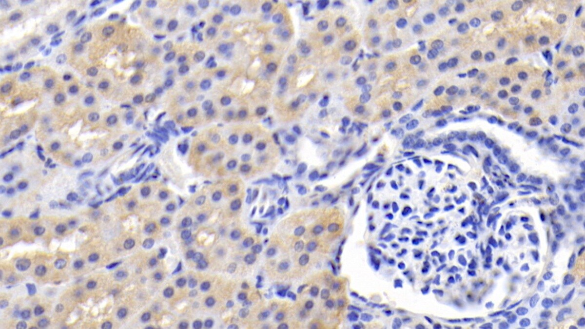 BAI3 Antibody (C3)