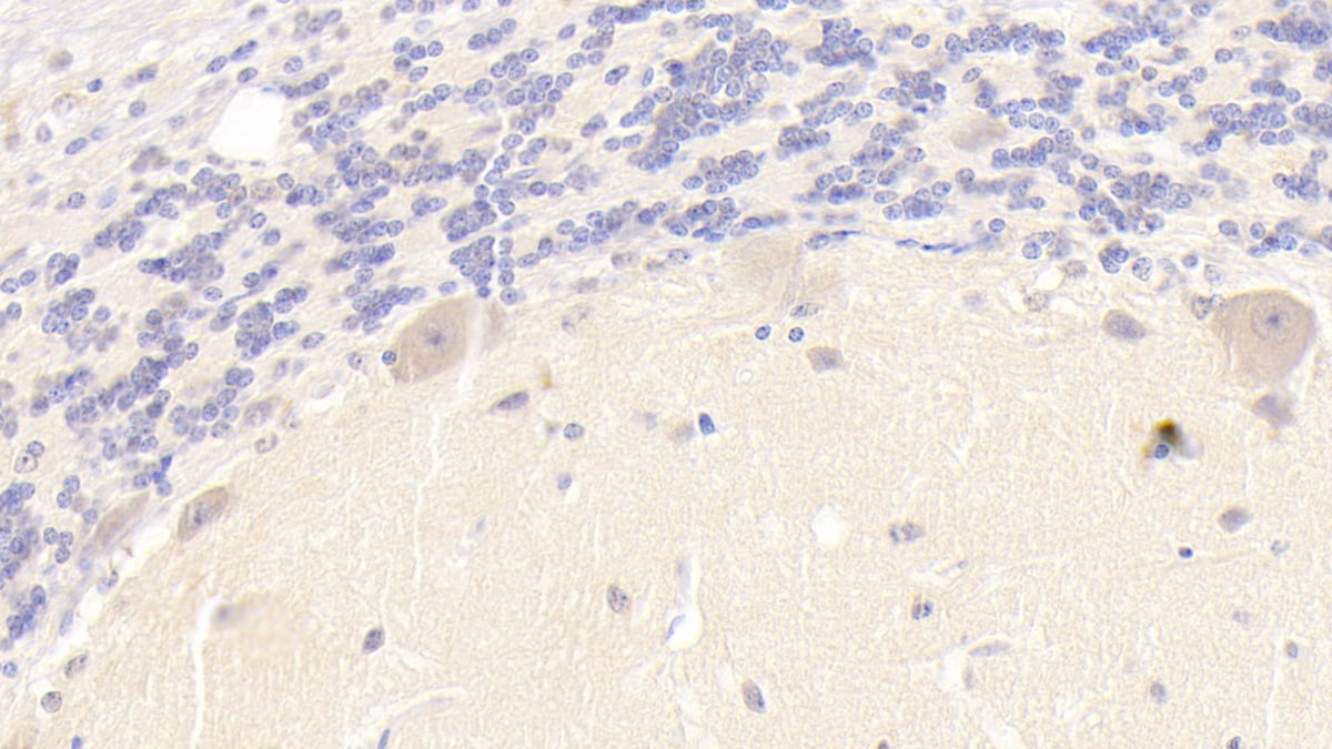Phospholipase B1 Antibody (C4)
