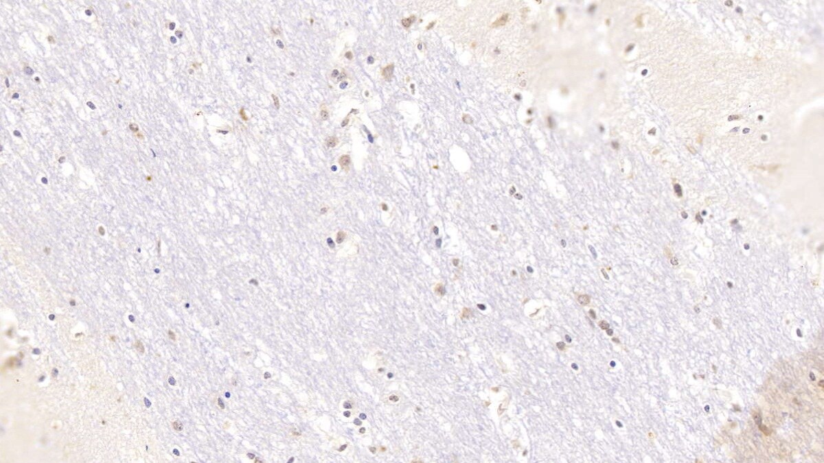 Serpin A10/ZPI Antibody (C10)