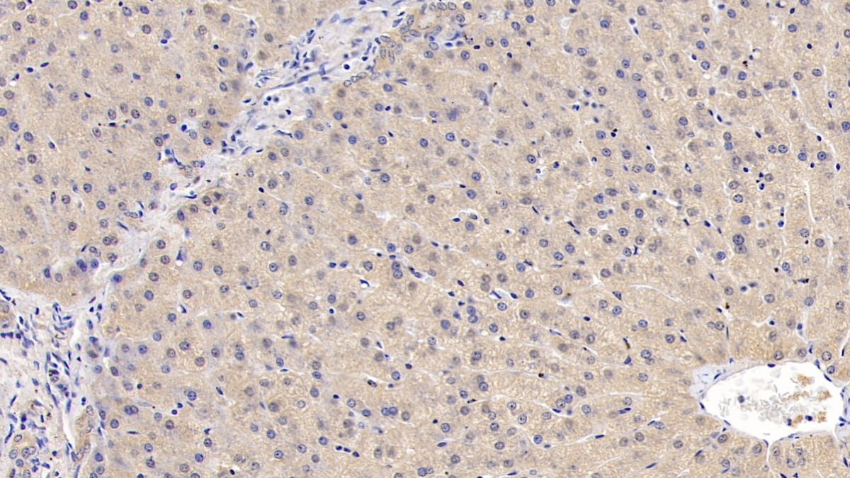 IL-29/IFN-lambda 1 Antibody (C11)