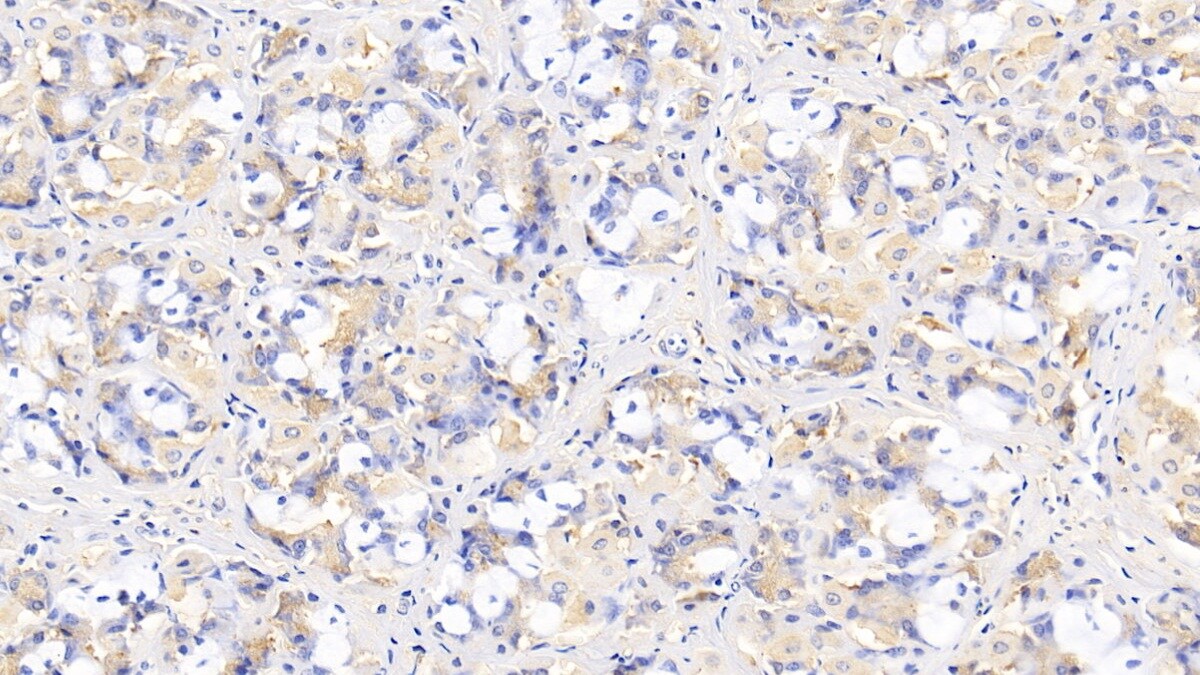 IL-29/IFN-lambda 1 Antibody (C1)