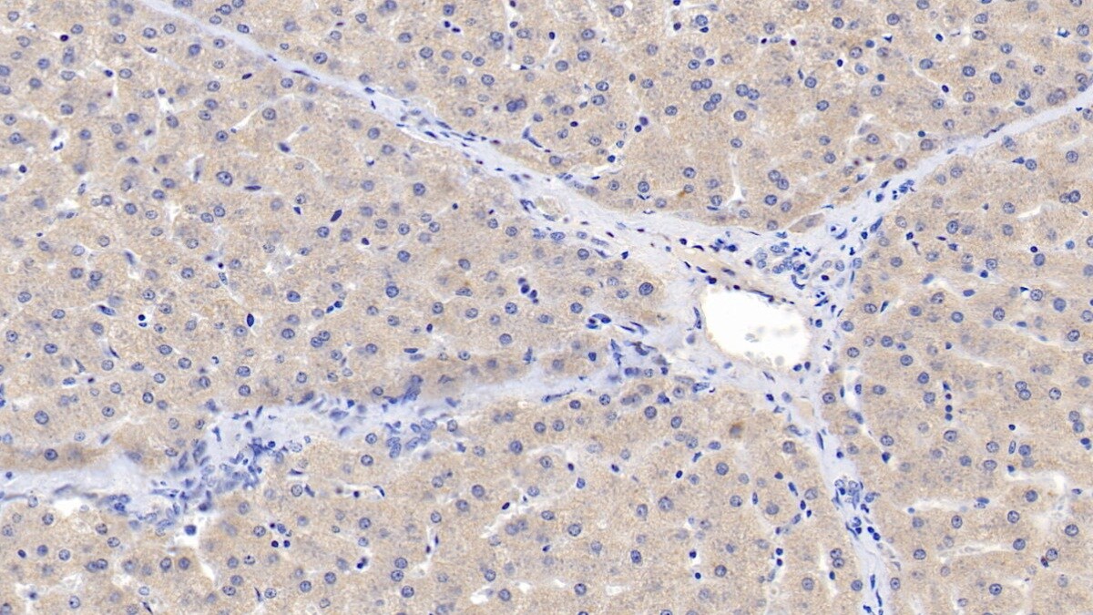 Activin RIIA Antibody (C8)