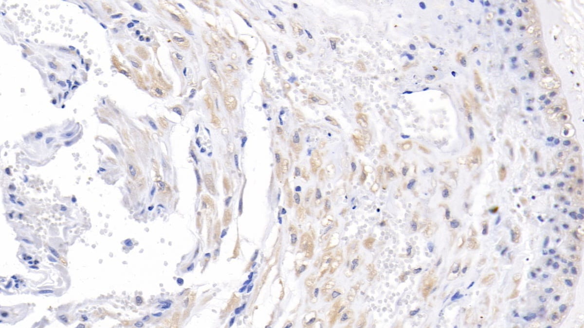 Activin RIIA Antibody (C8)