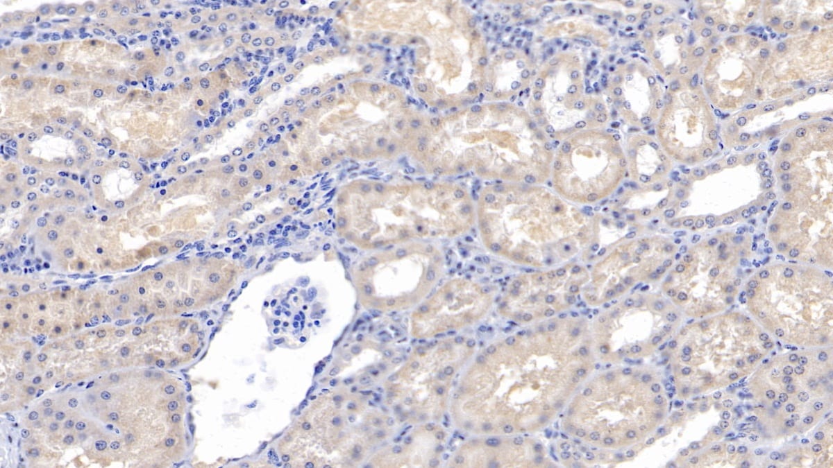Activin RIIA Antibody (C8)