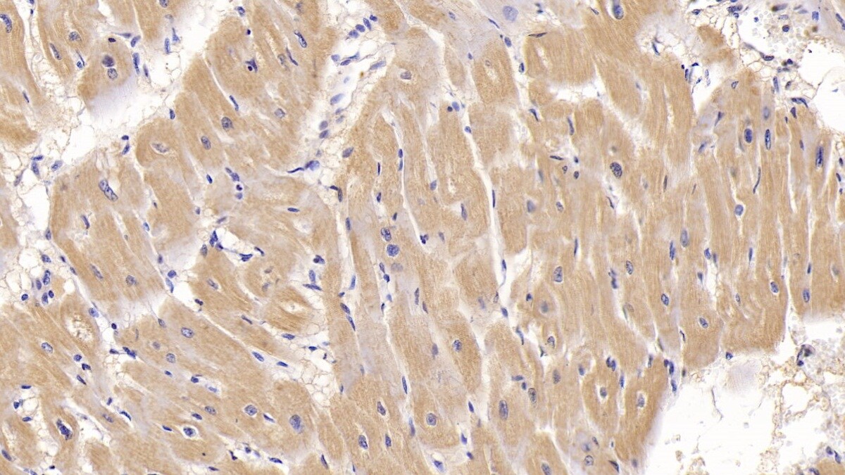 Activin RIIA Antibody (C1)