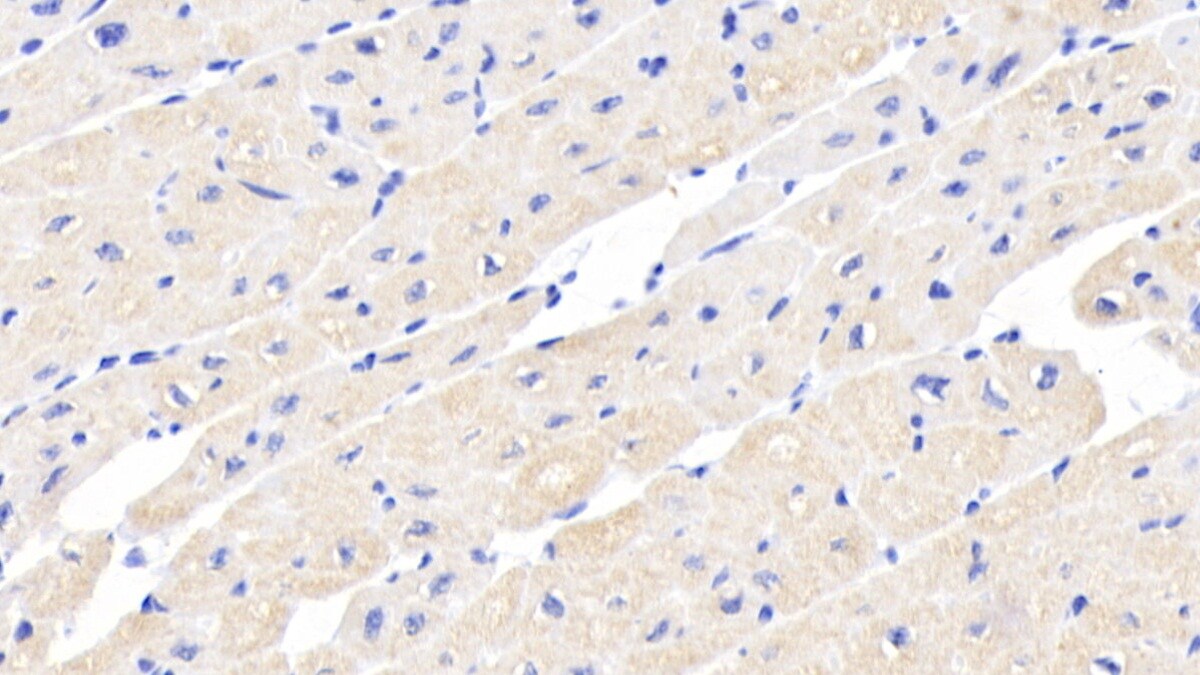 Activin RIIA Antibody (C7)