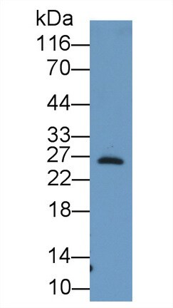 Noggin Antibody (A5)