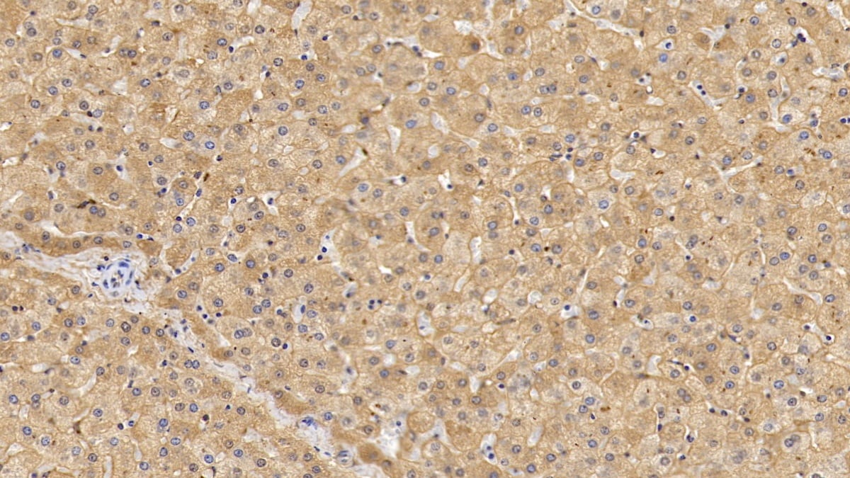 Lipolysis Stimulated Lipoprotein Receptor Antibody (C12)