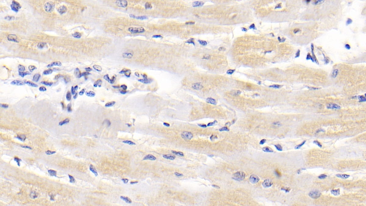 Lipolysis Stimulated Lipoprotein Receptor Antibody (C1)