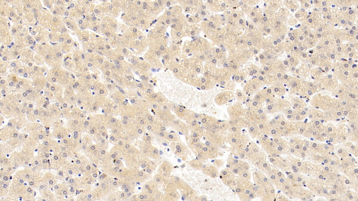 Lipolysis Stimulated Lipoprotein Receptor Antibody (C1)
