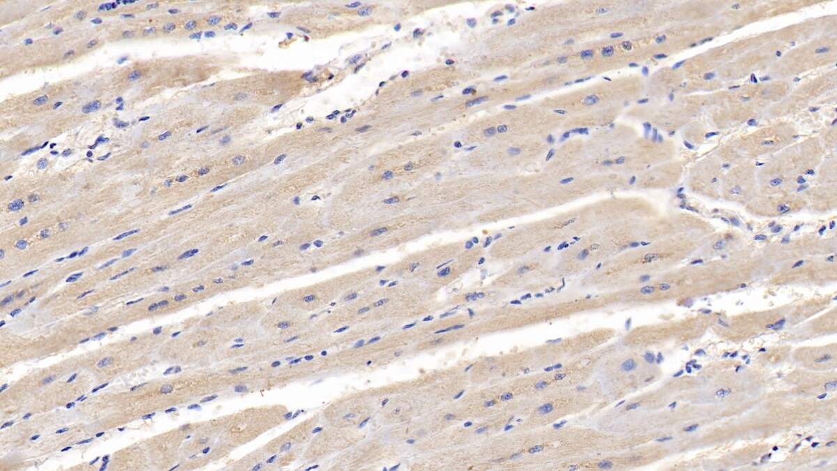 Lipolysis Stimulated Lipoprotein Receptor Antibody (C10)