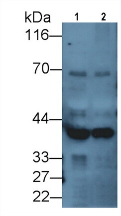 DCLK1 Antibody (C1)