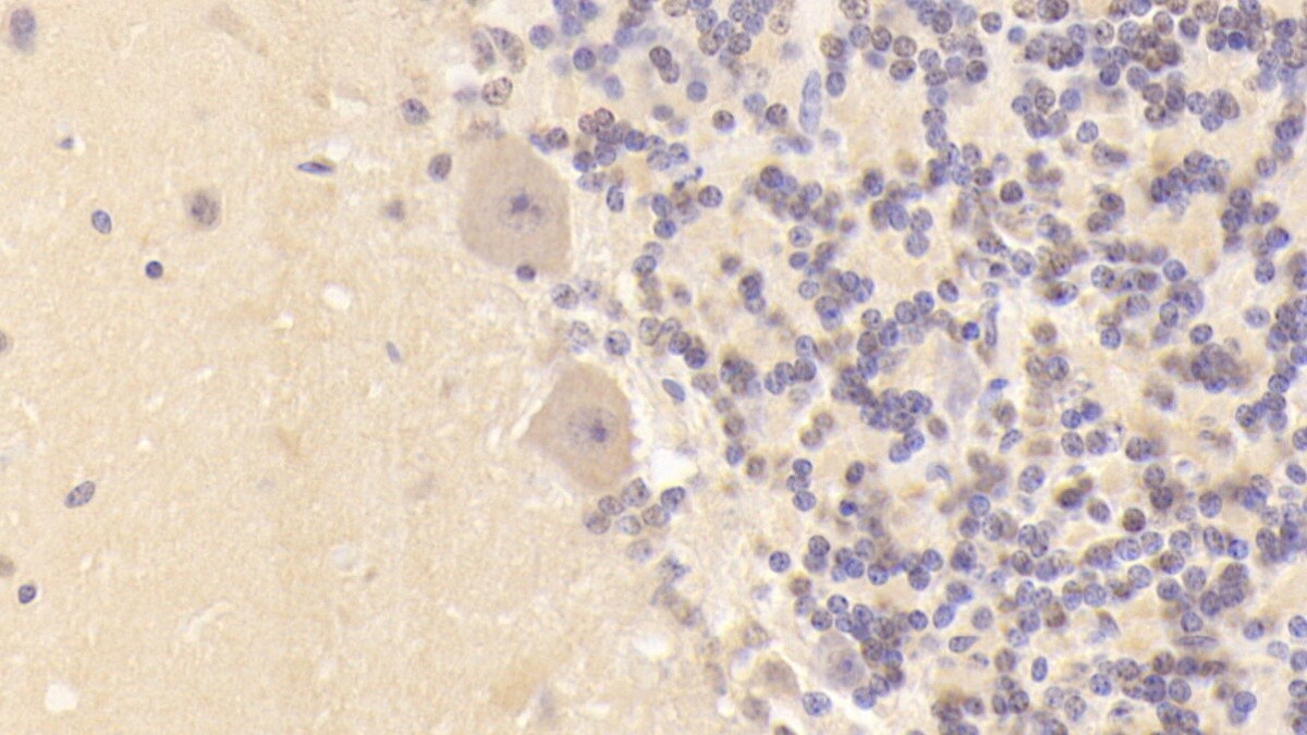 DCLK1 Antibody (C1)