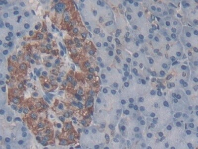Collectrin/TMEM27 Antibody (C2)