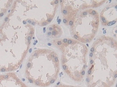 Collectrin/TMEM27 Antibody (C2)