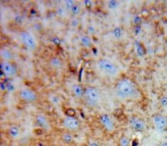 TAFA4/FAM19A4 Antibody