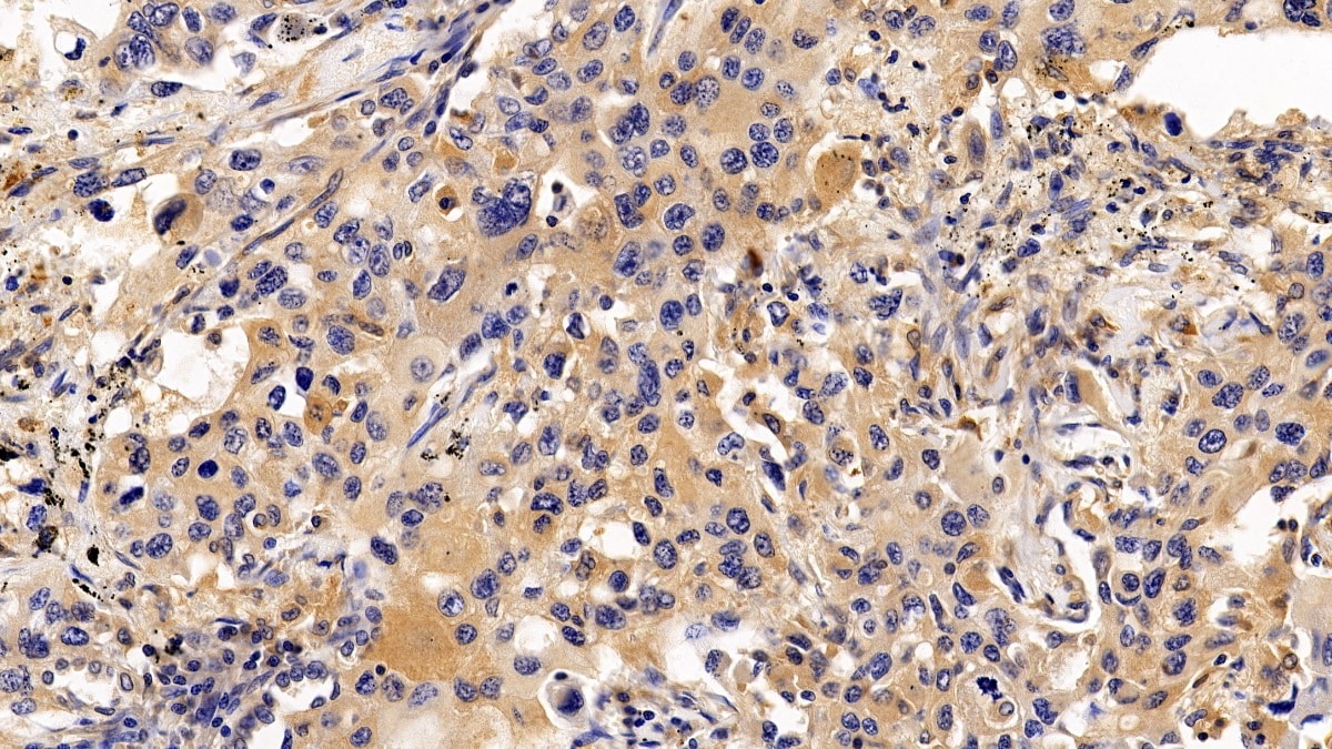 RGS19 Antibody
