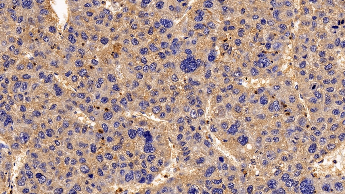 RGS19 Antibody