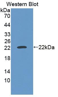 SCAND3 Antibody
