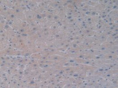 BMP-10 Antibody (A1)