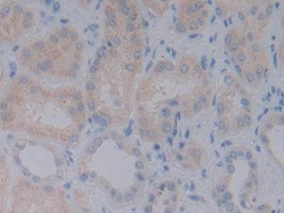 BMP-10 Antibody (A1)