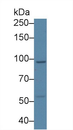 USP6NL Antibody