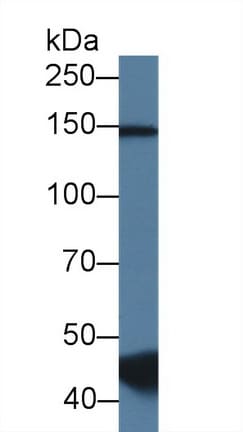 RBM20 Antibody